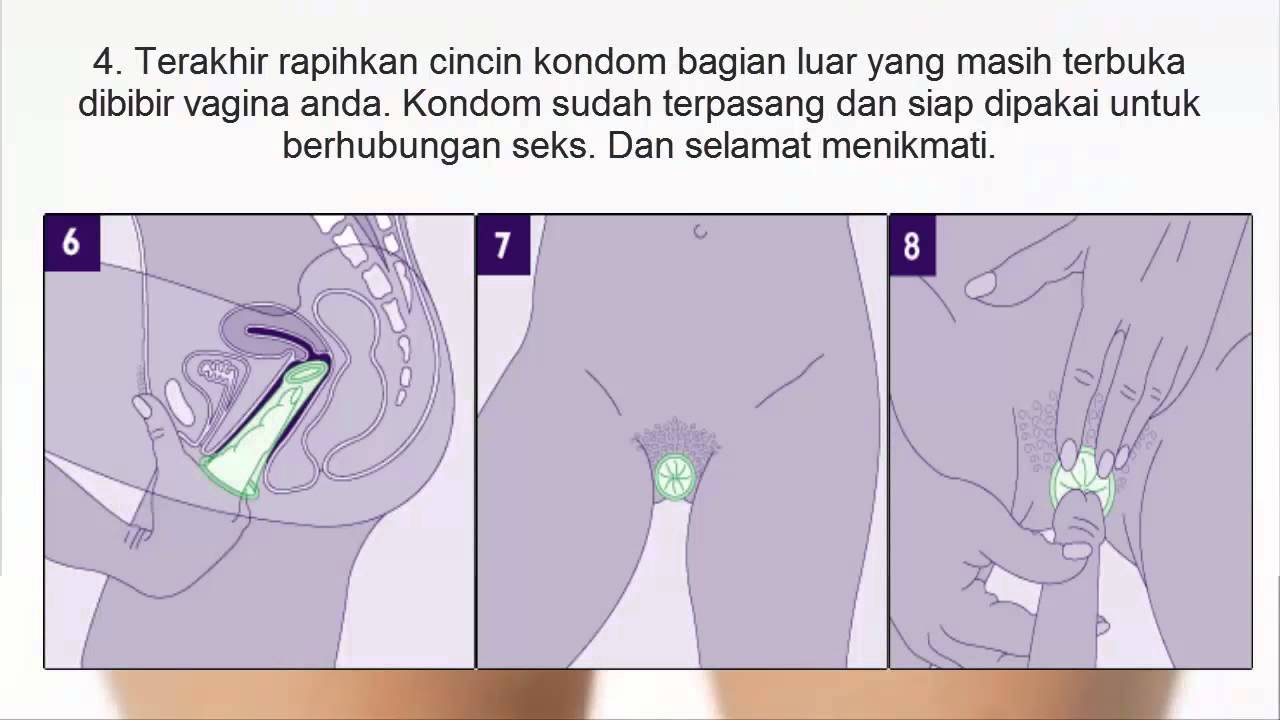 kondom wanita